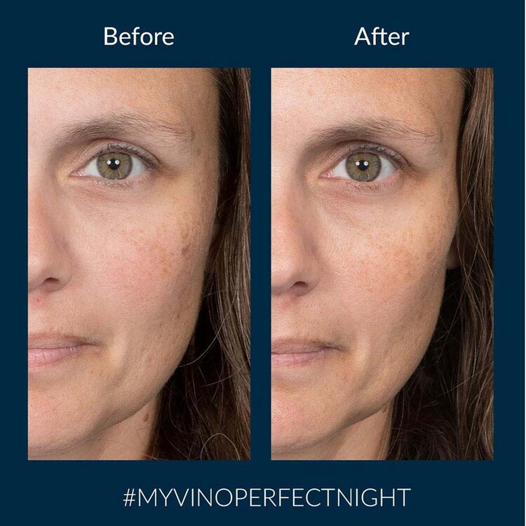 Caudalie Vinoperfect Dark Spot Correcting Glycolic