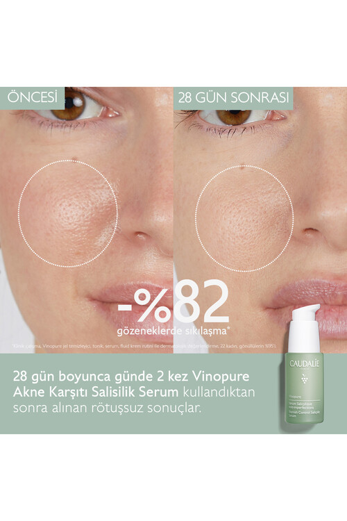 Caudalie Vinopure Salisilik Serum 30 ml