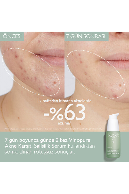 Caudalie Vinopure Salisilik Serum 30 ml