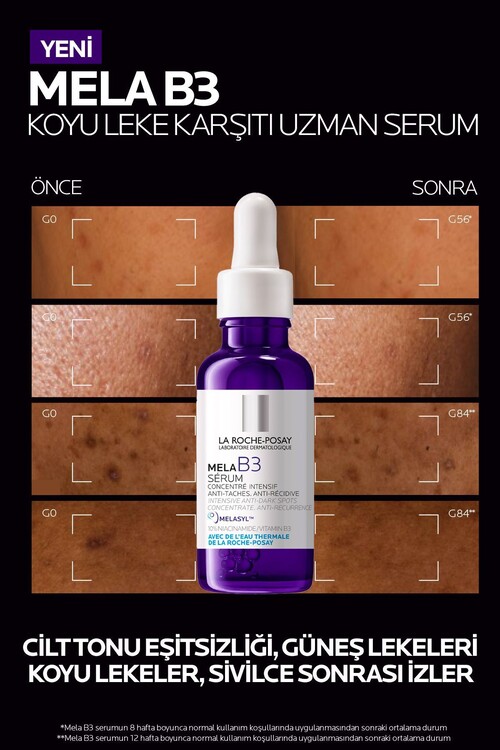 Uzman Leke Karşıtı Serum Seti:Mela B3 Leke Serumu 30ML&Age Correct Güneş Kremi 15ML&Çanta